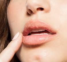 Whoopie® Hydrating Lip Balm